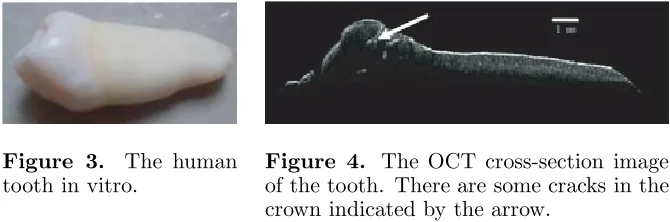 Figure 3.tooth in vitro.