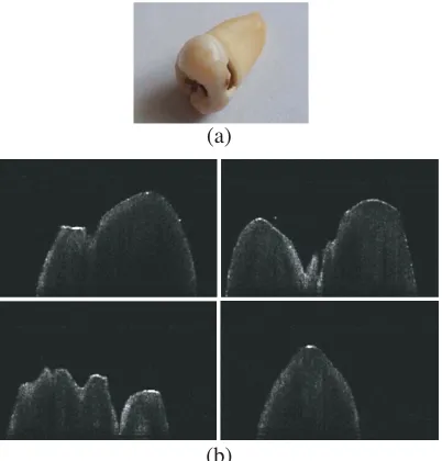 Figure 8. The crown image and its contour. (a) The original image,(b) The histogram equalization result, (c) the contour of it.