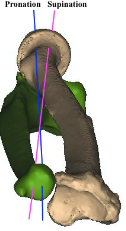 Figure 1. 17 Change in axis of rotation(AOR) during forearm rotation AOR moves in an ulnar to radial direction as the forearm moves from pronation to supination