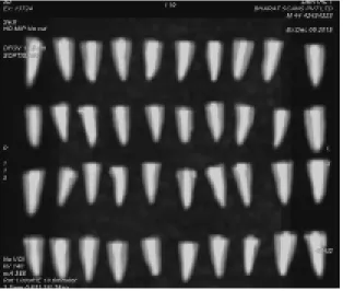 Fig No.12 Volume analysis after obturation  