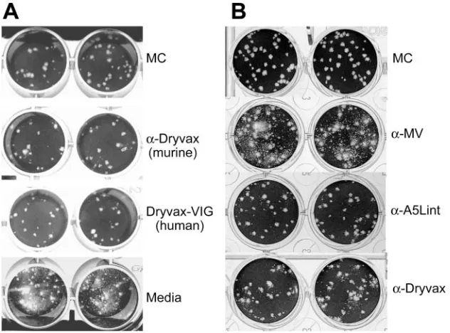 FIG. 5. EV-speciﬁc antibody titers in VIG. The EV-speciﬁc anti-body titer in human VIG-IV was determined by ELISA for each