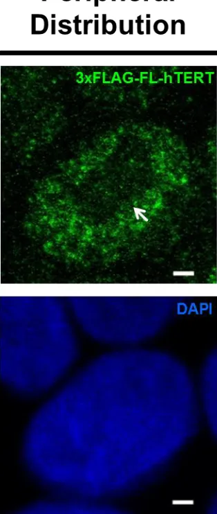 Fig. 2.2: Representative confocal microscopy images of ‘uniform’ and ‘peripheral’ intra-nuclear distribution of 3xFLAG-FL-hTERT within nuclei