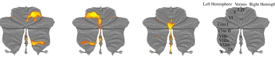 Figure 1. Motor Feature Maps. Group-averaged activation estimates for right hand presses (A), left hand presses (B), and saccadic eye movements (C) presented on a flat-map representation of the cerebellar surface where lobules (I-X) are demarcated by dashe