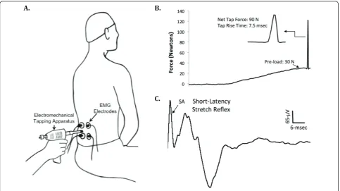 Figure 3 Schematic illustration of the high-velocity low-amplitude spinal manipulation technique.