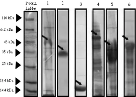 FIG. 1. Expression of several recombinant streptococcal proteinson a Coomassie blue-stained SDS-polyacrylamide gel