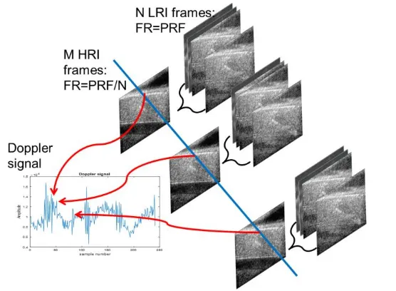 Figure 1.4: Construction of a high resolution image and a Doppler ensemble. 