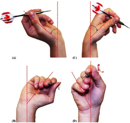 Figure 1.15: Range of Wrist Motion: Dart Throw.  Wrist joint motion in combined wrist extension (A) 