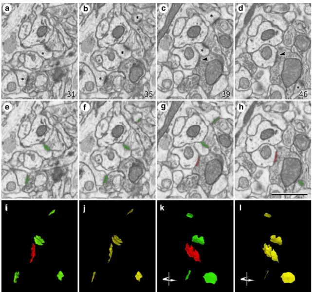 Figure 3.  Identification and segmentation of synaptic junctions in serial sections acquired by FIB-SEM