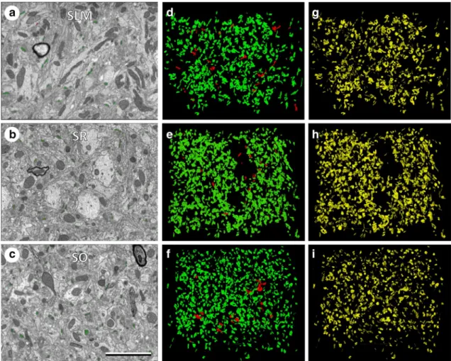 Figure 4.  Measuring synaptic densities and sizes in stacks of sections obtained by FIB-SEM