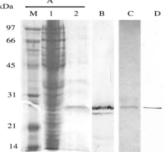 FIG. 2. Deduced amino acid sequence of the anti-CR1 scFv. The framework regions (FR), complement-determining regions (CDR; boldfaceletters), cysteine residues for disulﬁde bond formation, glycine-serine linker, and hexahistidine and HA tags are indicated.