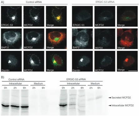 Figure 2: ERGIC-53 is required for the intracellular retention of MCFD2. A) HeLa cells were transiently transfected with control orERGIC-53 siRNA duplexes