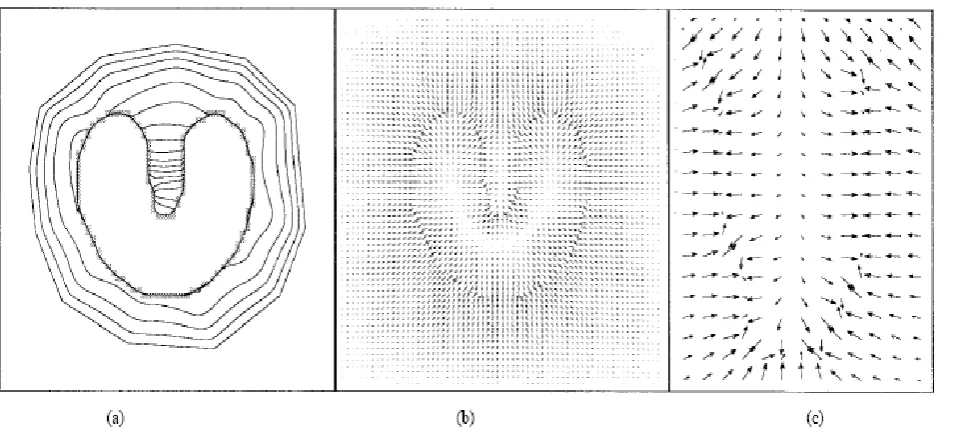 Figure Carpal bone segmentation using snake algorithm. (a) Initial contour. (b) Final result