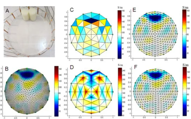 Fig. 15. (A) reconstructedelements. (F) Phantom withd onto eleme) Fine model rh two pieces ents