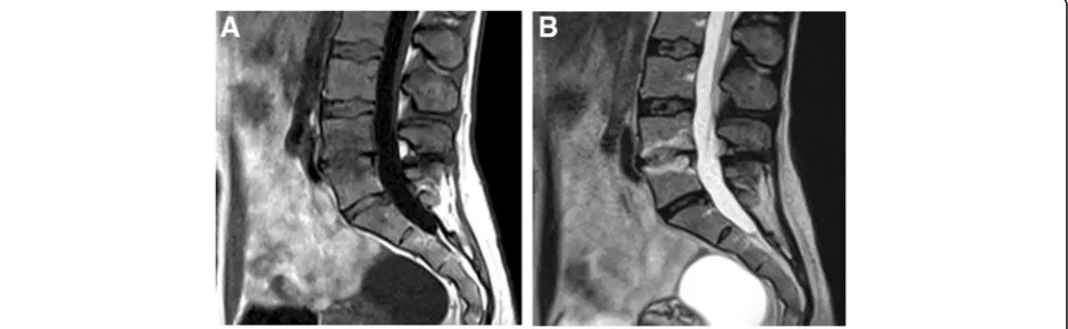 Fig. 1 Course of MC types of primary MC during one-year follow-up. Arrows indicate the change of MC type (in percent)