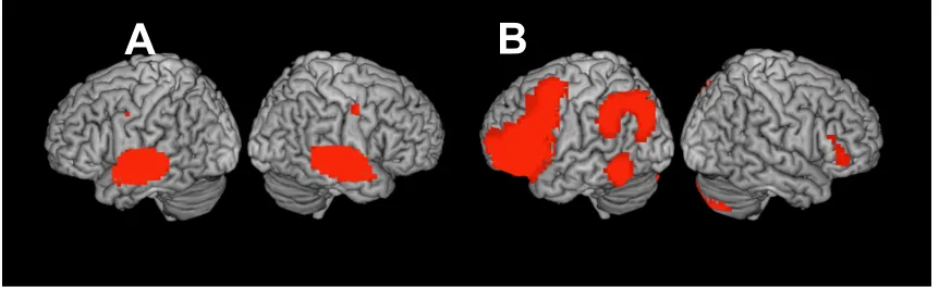 Figure 3. Group ICA results. A: Auditory network. B: Fronto-parietal. 