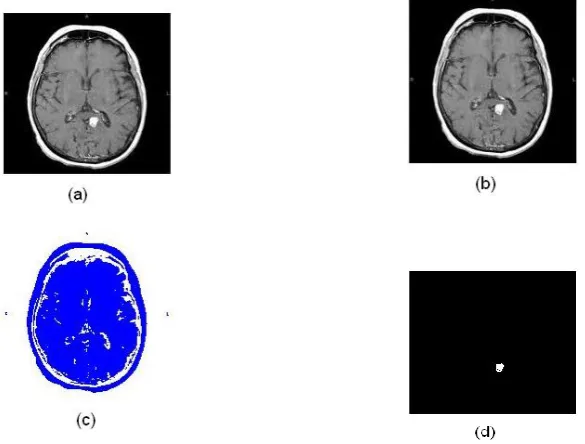 Fig 4.1 a, b, c, d (a) Input Image (b) Preprocessing Image (c) Color Based Clustering (d) Segmented Image