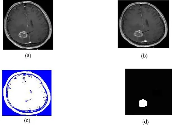 Fig 4.3 a, b, c, d (a) Input Image (b) Preprocessing Image (c) Color Based Clustering (d) Segmented Image
