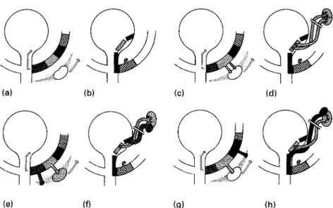 Figure 1. A. Wolffian duct zones are shown in relation to nephrogenic area. Note direction of migration of kidney cranially and Wolffian duct into developing bladder.