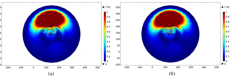 Figure 4. Spatial distribution of normalized E-ﬁeld inside the Zubal head phantom (slice 36) at 1 GHz.(a) Normal head phantom