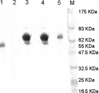 FIG. 4. Immunocapture ELISA for titration of diabody D06 with different concentrations of rabies virus antigen.