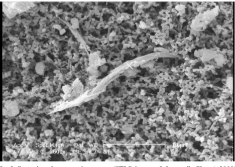 Fig. 3. Scanning electron microscope (SEM) image of actinolite fiber (×5000) Table 3. Different types and components of asbestos fibers collected in outdoor and indoor