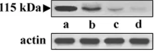 FIG. 1. Western blot analysis of the 115-kDa protease of L. dono-vaniand whole-cell extracts from virulent, avirulent, and attenuated strainsofimmunoblot detection with the anti-115-kDa serine protease antibody.Lane a, puriﬁed protease (2ofdonovanilate-pas