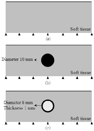 Figure 1:  (a) Schematic representation of the contact of sensor and soft tissue and (b) The finite element model and the boundary conditions