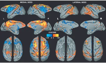 Figure 2.2. Right medial (left) and right lateral (right) FEF seed connectivity maps projected on the F99 template (Van Essen 2004) (z-score 5 set at cluster significance of P 0.05, corrected for multiple comparisons)
