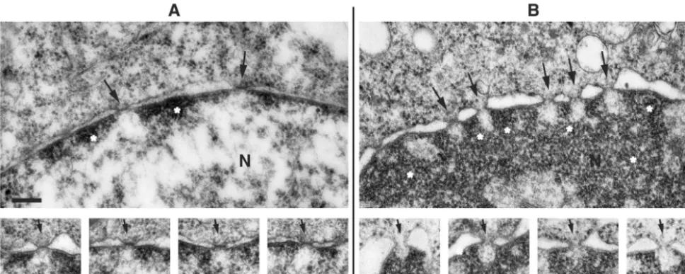 FIG. 4. Electron microscopy of nuclear envelope and nuclear pores of uninfected and infected HeLa cells