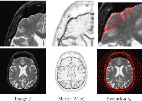 Fig. 3.4 Example of geodesic active contour evolution for medical image segmentation.