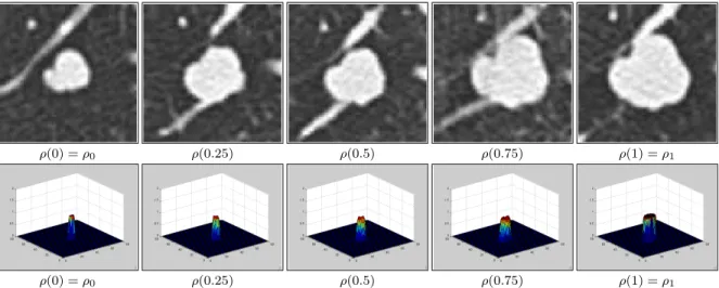 Fig 6 . Plot of a growing tumor simulation from an initial and final stage. Top: B/W images; Bottom: corresponding density plots.