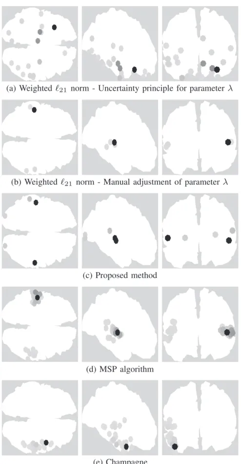 Fig. 7. Results for real data auditory evoked responses: Active dipole positions estimated by different algorithms
