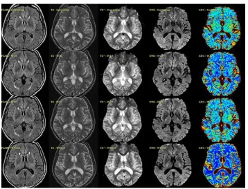 Fig 1: Multi spectral MR Images. 