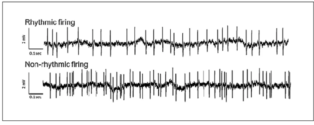 Figure 2.18: An example of signals recorded using glass electrode showing rhythmic neuronal firing and non-rhythmic neuronal firing