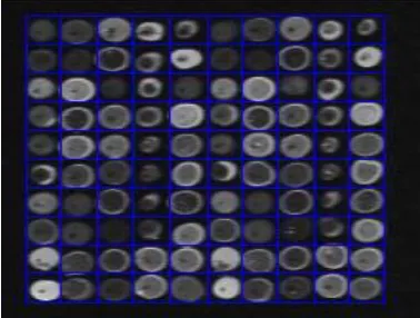 Figure 4.3 Global Threshold Image 