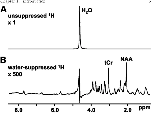 Figure 1.2: Differences between suppressed (A) and unsuppressed (A) spectra. The x-axis measures the chemical shift of the spectra in ppm