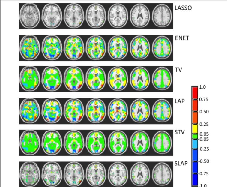 FIGURE 4 | Coefficient maps for different models when the model selection criterion ACC/Corr is employed.