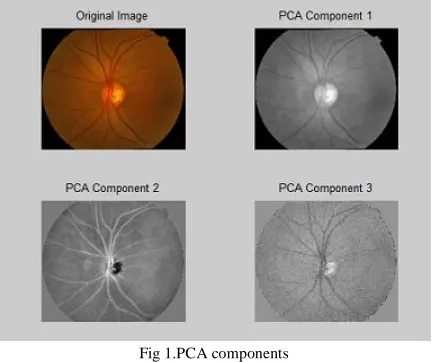 Fig 1.PCA components 