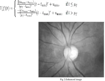 Fig 2.Enhanced image 
