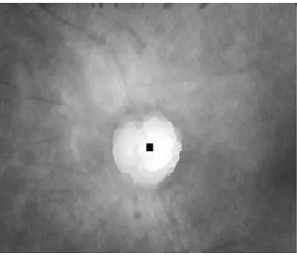 Fig 3. A)vessels to be inpainted, B) inpainted image.  