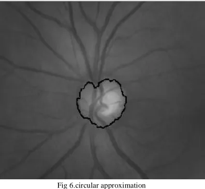 Fig 5. segmented image 