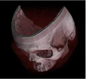 Fig. 4: Shading 