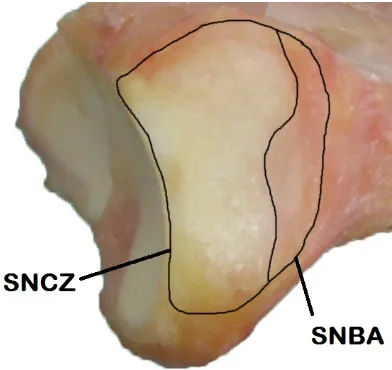 Figure 1.8: Radius of curvature and cartilaginous coverage of the ulnar head and sigmoid notch