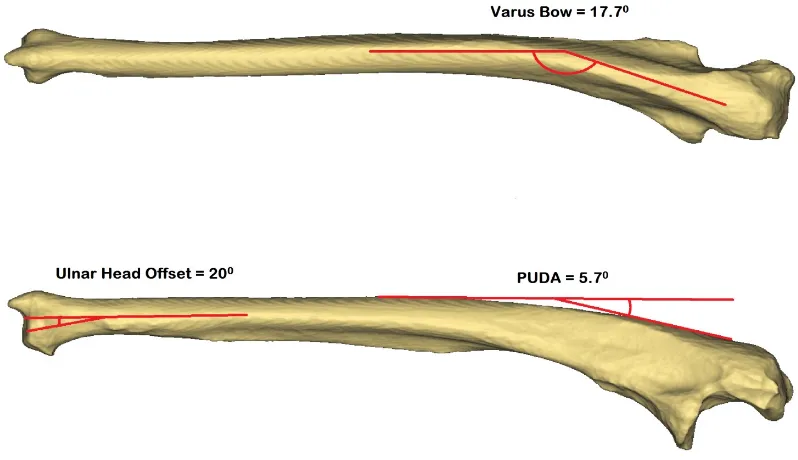 Figure 1.12: Bony anatomy of the ulna depicting the ulnar head offset, varus bow and proximal ulna dorsal angulation (PUDA) (© B Gammon)