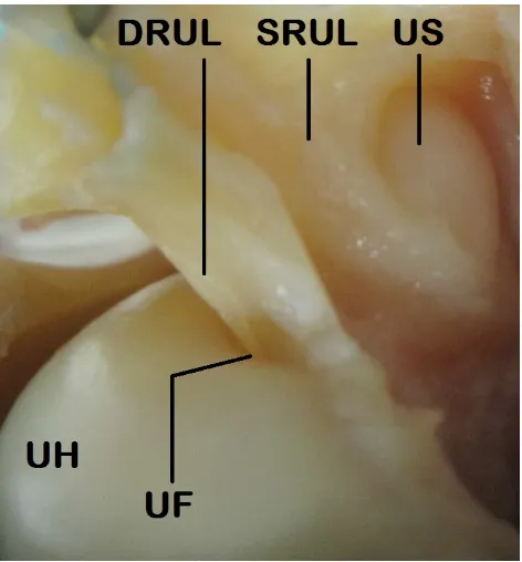 Figure 1.14: A magnified view of the superficial fibers (SRUL) and deep fibers (DRUL) of the radioulnar ligaments, which attach onto the ulnar fovea (UF) and ulnar styloid (US)