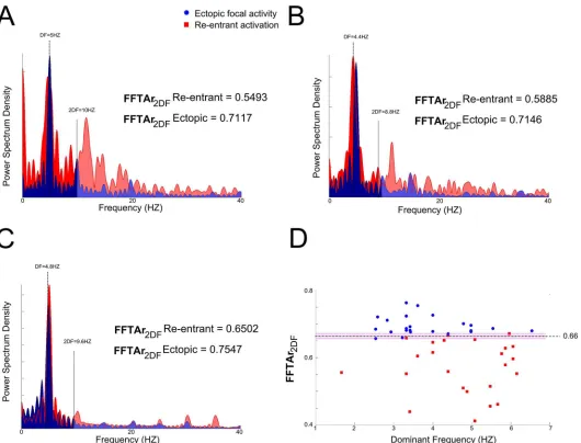 Fig 5. Normalized power spectral density for ectopic focal and re-entrant activation. Normalized power spectral density for ectopic focal (blue) and re-entrant (red) activity located in (A) SAN; (B) PV and (C) RAA