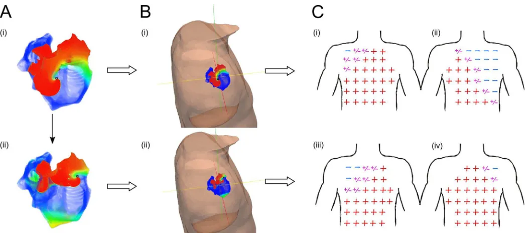 Fig 7. Comparison of quadrants position and atrial-waves polarity maps in meandering re-entrant activation