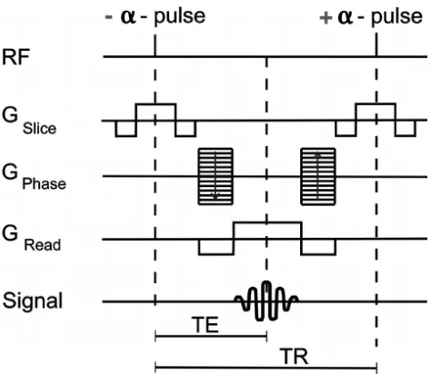 Figure 2: Balanced steady-state free precession pulse sequence diagram. The time to form an echo (TE) is commonly set to ½ the repetition time (TR)