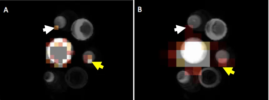 Figure 4: Cell pellets containing 20,000 (white arrow) and 60,000 (yellow arrow) 