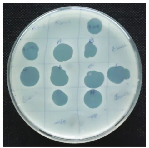 FIGURE 2: Antibiogram test of S. aureus isolate. The isolate was resistant to: ceftazidime, 30 µg (1); oxacillin, 1 µg (2); vancomycin, 30 µg (4); netilmicin, 30 µg (6); gentamicin, 10 µg (7); erythromycin, 15 µg (8); and cefuroxime, 30 µg (5)